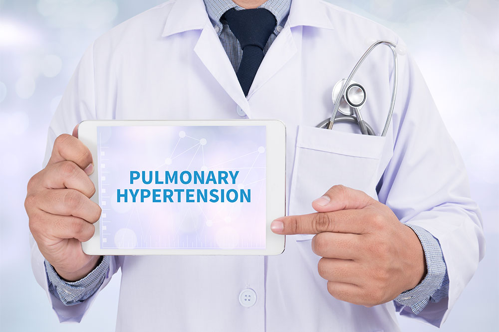 Causes and Risk Factors of Pulmonary Arterial Hypertension