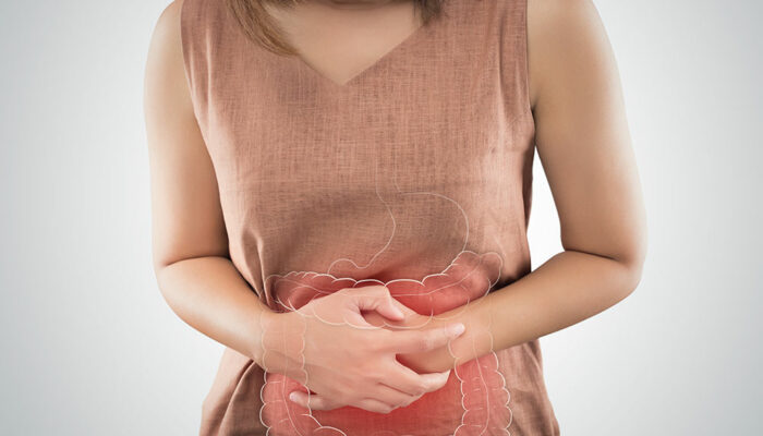 Risk Factors and Signs of Ulcerative Colitis